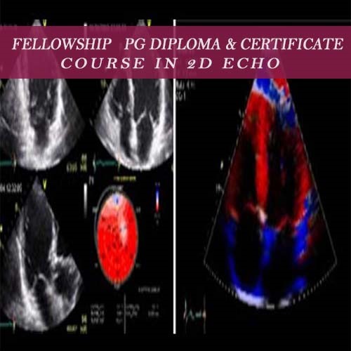 2D Echo Technician Course